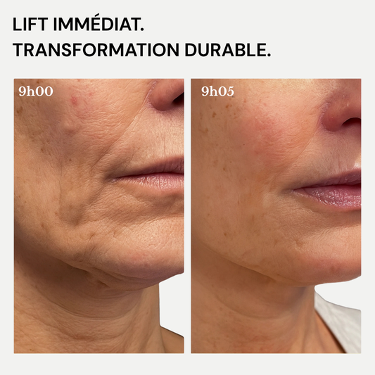 Glowe Lifting Cream : Retrouve ton éclat.