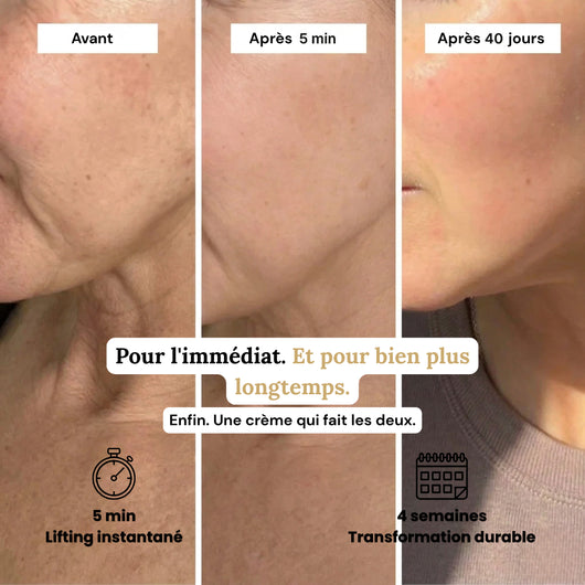 Glowe Lifting Cream : Retrouve ton éclat.